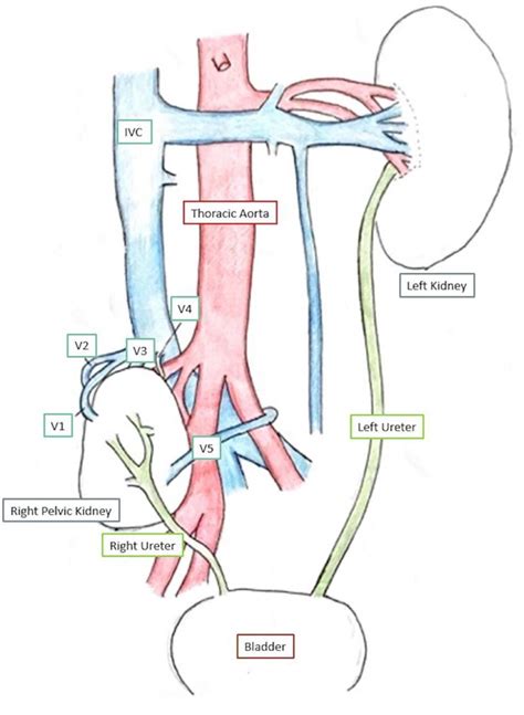 Kidney Schematic