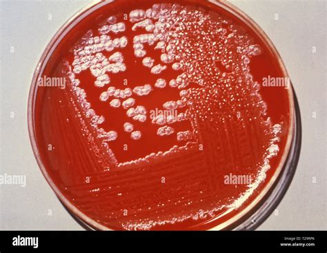 Bacillus Anthracis