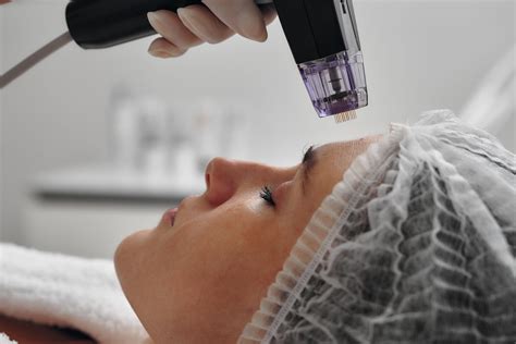 1 Best MNRF Treatment Cost In Delhi India Advanced Micro Needling