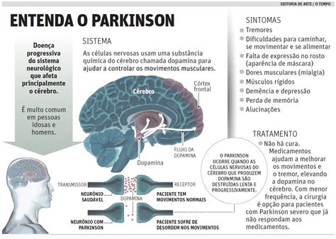 Porque perdem a memória os doentes de Parkinson Science Platform PT