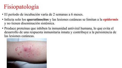 Molusco Contagioso PPT