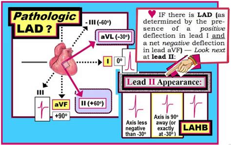 Ecg Interpretation December 2010