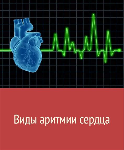 Виды аритмии сердца | Лечение, Здоровье сердца, Короткие тренировки
