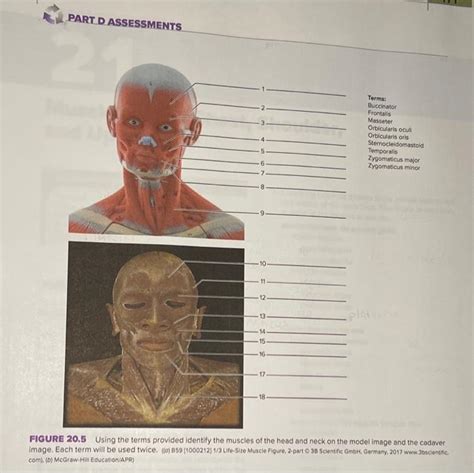 Solved Part D Assessments Terms Buccinator Frontalis Chegg