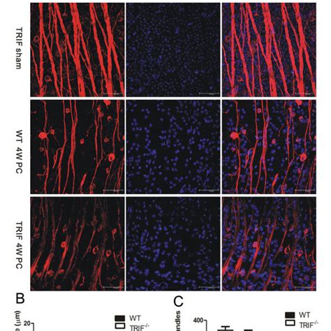 Microglial Activation In Whole Mount Retina And Microglial Migration In