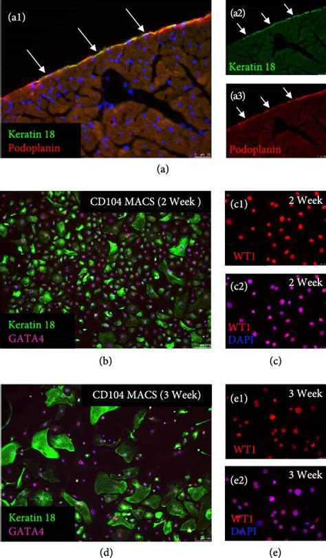 The Neural Progenitor Cell‐associated Transcription Factor Foxg1 Regulates Cardiac Epicardial