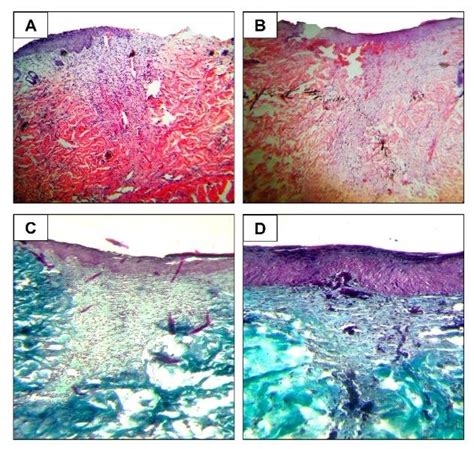 Histopathology Changes In Wistar Rats During Incision Wound Healing