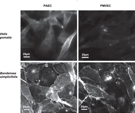 Figure 1 From Transforming Growth Factor Cid 1 1 Causes Pulmonary