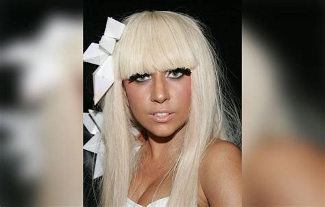 Lady Gaga S Plastic Surgery Makeover Exposed By Top Docs