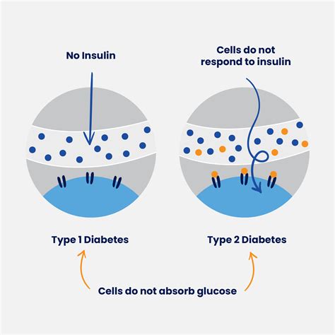 Understanding Diabetes And The Glycaemic Index Gi Gen Physio