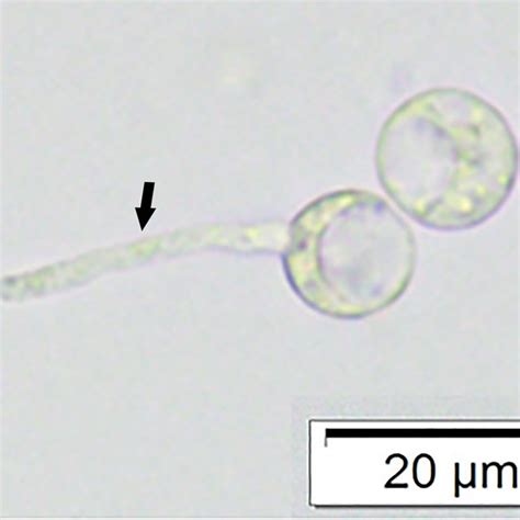 Zoospores of P. insidiosum and zoospore germination shows short hypha... | Download Scientific ...