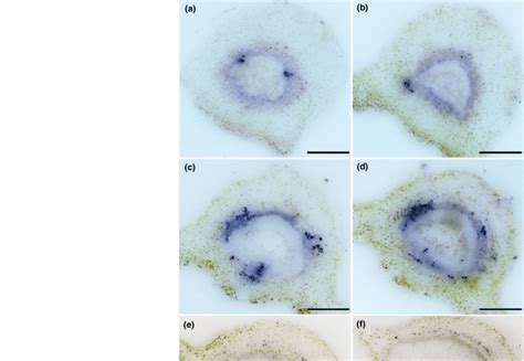 Uneven Distribution Pattern Of Candidatus Liberibacter Asiaticus