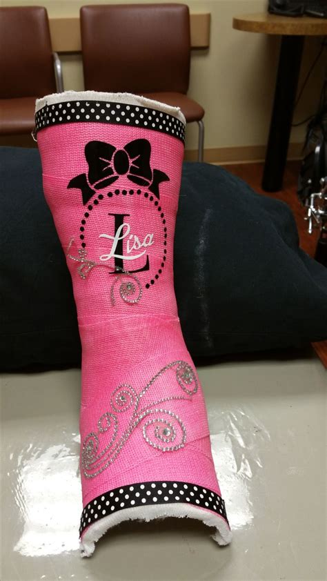 decorative leg cast … | Arm cast, Leg cast, Cast decoration