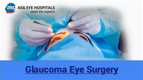 Ppt Glaucoma Eye Surgery Asg Eye Hospitals Powerpoint Presentation