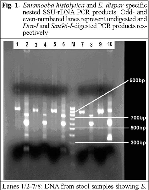 Pdf Entamoeba Moshkovskii And Entamoeba Dispar Associated Infections In Pondicherry India