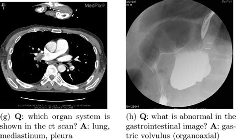 Figure 1 From VQA Med Overview Of The Medical Visual Question