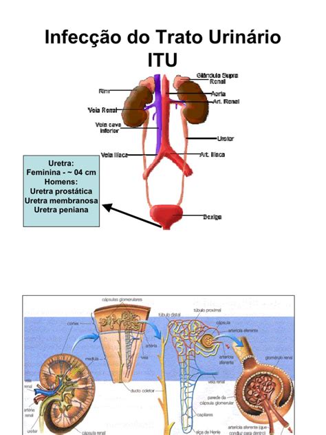 Itu Aula Infecção Do Trato Urinário Especialidades Médicas