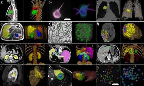 Why Deep Learning Is Useful In Medical Imaging Datafloq