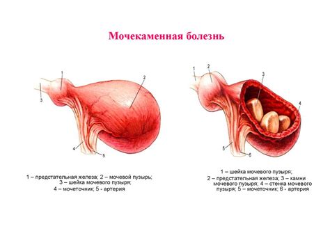 Мочеполовой аппарат. Органы мочеотделения. (Лекция 5) - презентация онлайн