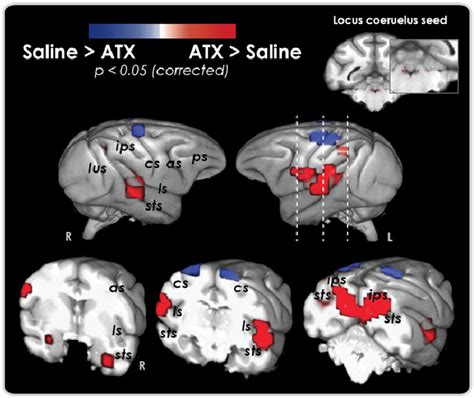 Functional Connectivity Pattern Of A Brainstem Region Including The Lc