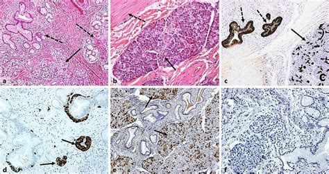 A He Staining Showing The Gallbladder Glands Dashed Arrows And The