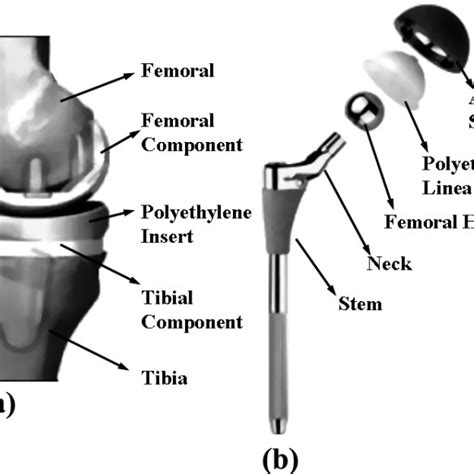 Titanium Orthopedics Medical Devices A Total Knee Replacement B Download Scientific