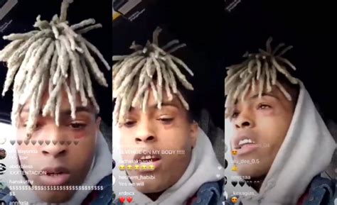 Xxxtentacion Dead Rapper Dies Age 20 After Being Shot In Miami In