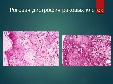 Distrophia - презентация онлайн