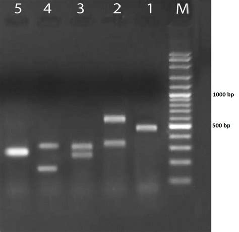 Patterns Of Pcr Rflp Products Of Candida Isolates After Digestion By