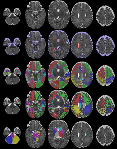 Newborn Baby Brain Scans Will Help Researchers Track Brain Development - Neuroscience News