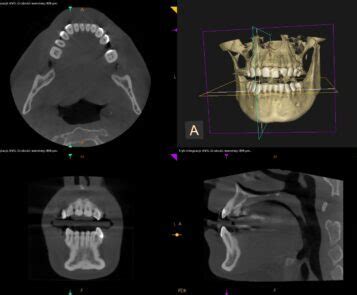 Nasze usługi Pracownia tomograficzna w Kaliszu 3D Tomografia