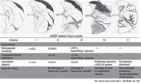 Splenectomy In Abdominal Trauma In The General Hospital Of Balbuena