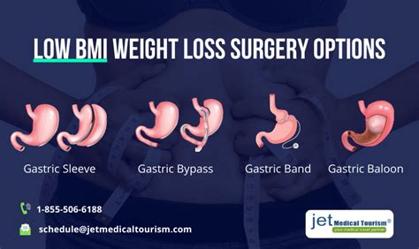 Weight Loss Surgery For Slightly Overweight Jet Medical Tourism