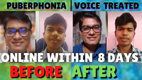 Pre Post 8 Days Online Puberphonia Voice Therapy By Slp Sanjay