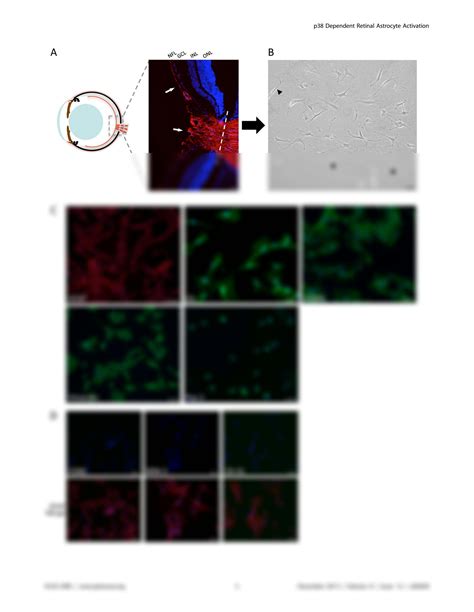 SOLUTION Ros Detoxification And Proinflammatory Cytokines Are Linked