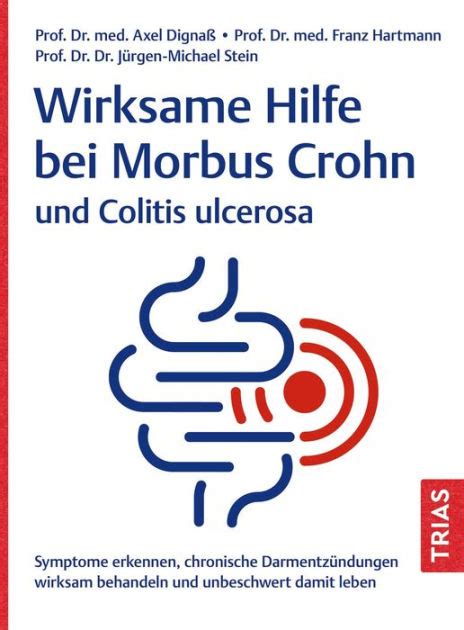 Wirksame Hilfe Bei Morbus Crohn Und Colitis Ulcerosa Symptome Erkennen