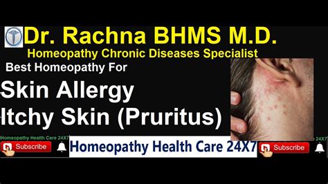 Homeopathy For Skin Allergy Youtube