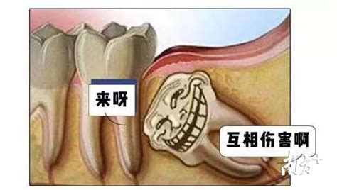 拔智齿瘦脸是真的吗拔智齿真能瘦脸吗中山医生揭露真相了 说明书网