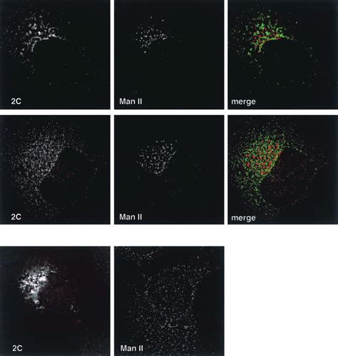 Subcellular Localization Of Man Ii And Fmdv C A Infected Cells