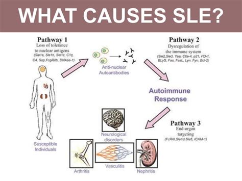 Systemic lupus erythematosus (SLE)