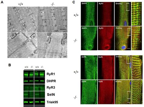 Ultrastructural Organization And Triadic Junctions In Sepn1 2 2 Adult