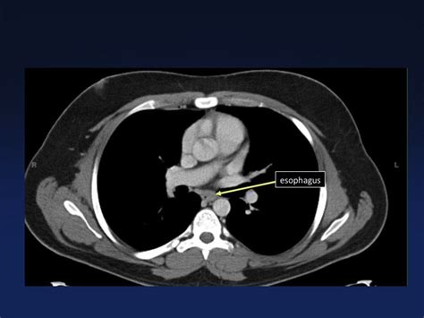 Cross Sectional Anatomy Of The Body Mdct Atlas Radiology Imaging