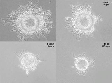 Phase Contrast Micrographs Showing Aoc Growth At 96 H In Fibrin Gel