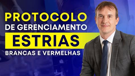 Desvende O Segredo Do Gerenciamento De Estrias Live Completa YouTube