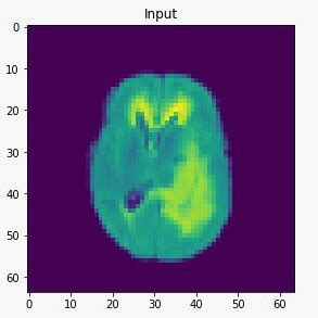 Rendering of T1, T1c, T2, and FLAIR at a resolution of 64 × 64 × 64 ...