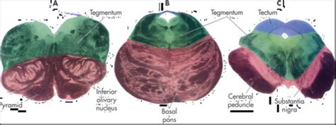 Brainstem Anatomy Flashcards Quizlet