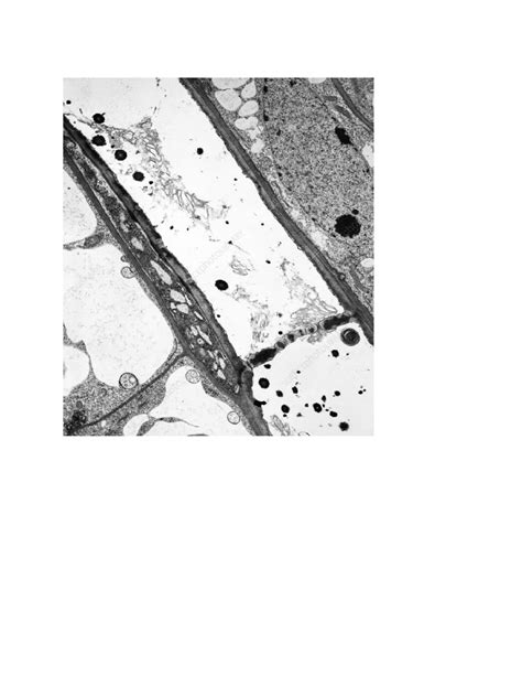 Phloem Micrograph | PDF