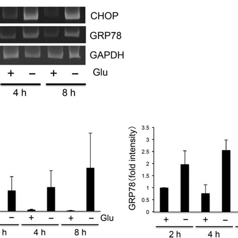 Glucose Deprivation Induced UPR In SH SY5Y Ob Rb Neuronal Cells A