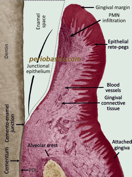 Junctional epithelium - periobasics.com Basic Periodontology