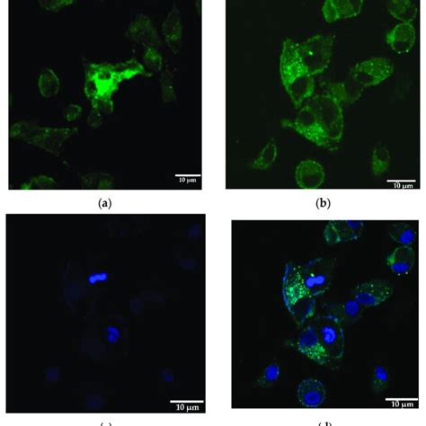 Subcellular Localization Of ORF3a GFP Fusion Protein In A549 Cells